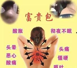 富贵包治疗视频,告别颈肩不适的康复指南